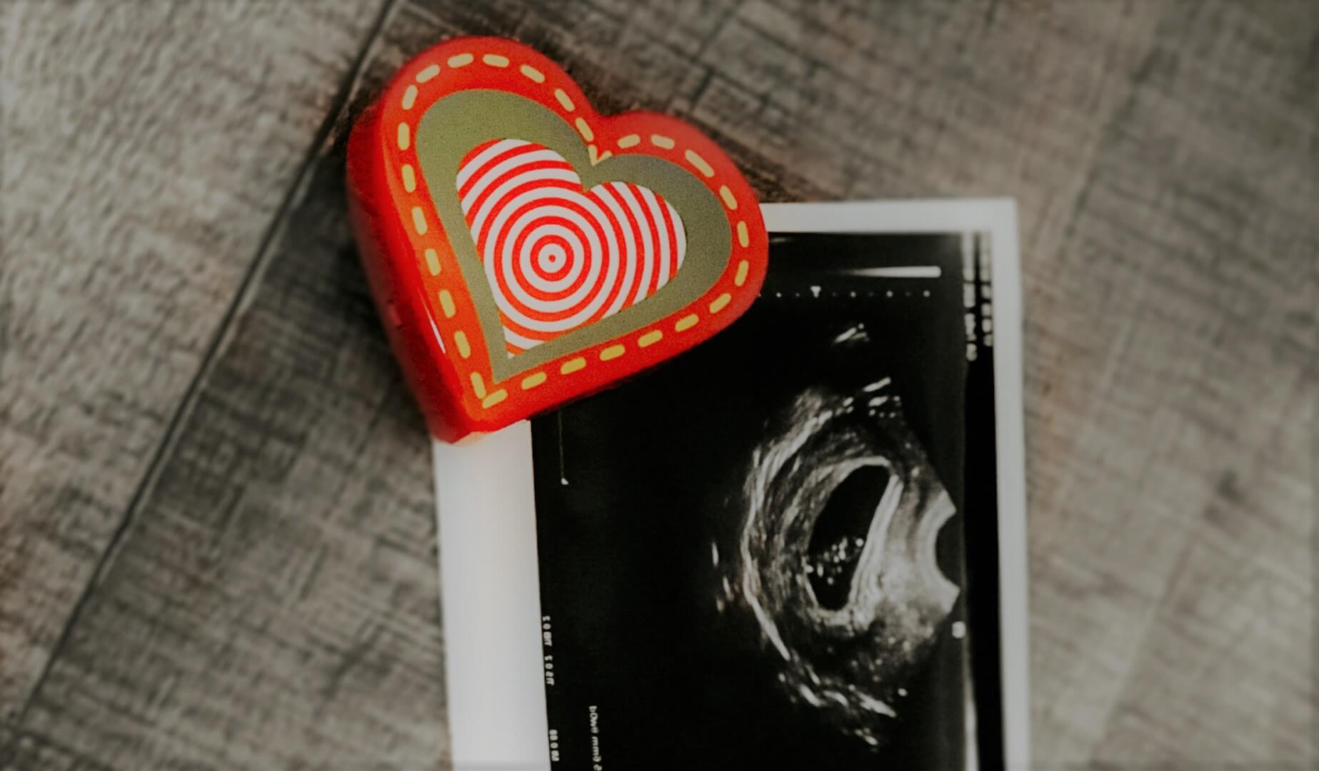 Pregnancy ultrasound photo and a wooden heart magnet Pregnancy ultrasound photo and a wooden heart magnet